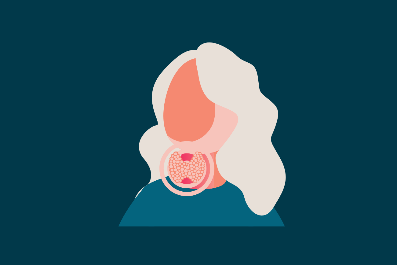 Fonction thyroïdienne et grossesse : revue de la recherche